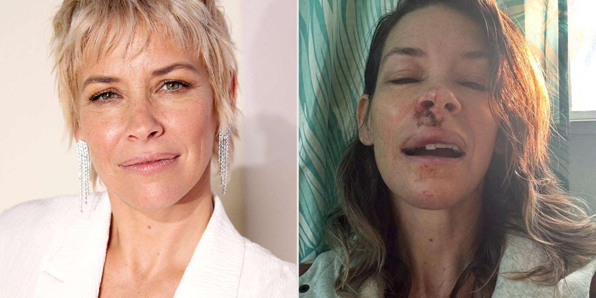 Evangeline-Lilly-D23-after-fall-010326-acf10f236c064bca96aebb2e74bdabf4.jpg - RevistaPolitica