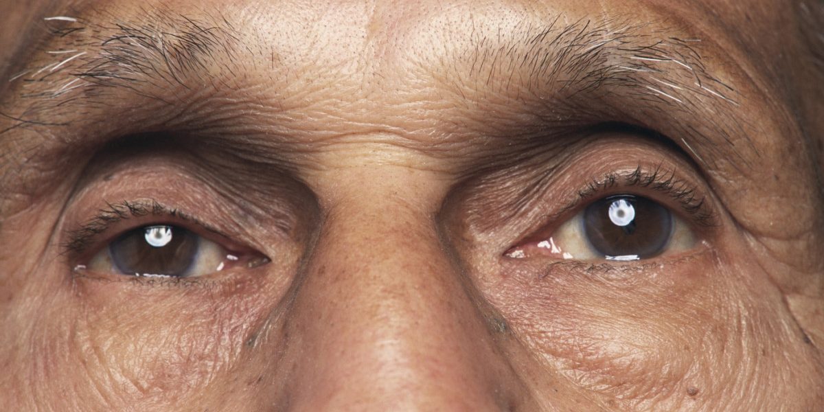 O bacterie prezentă în ochi, asociată cu boala Alzheimer și declinul cognitiv, arată un nou studiu