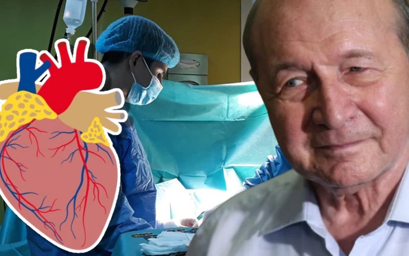 Fostul președinte Traian Băsescu a împărtășit studenților din Timișoara experiența sa medicală, dezvăluind detalii despre intervenția chirurgicală suferită la Viena